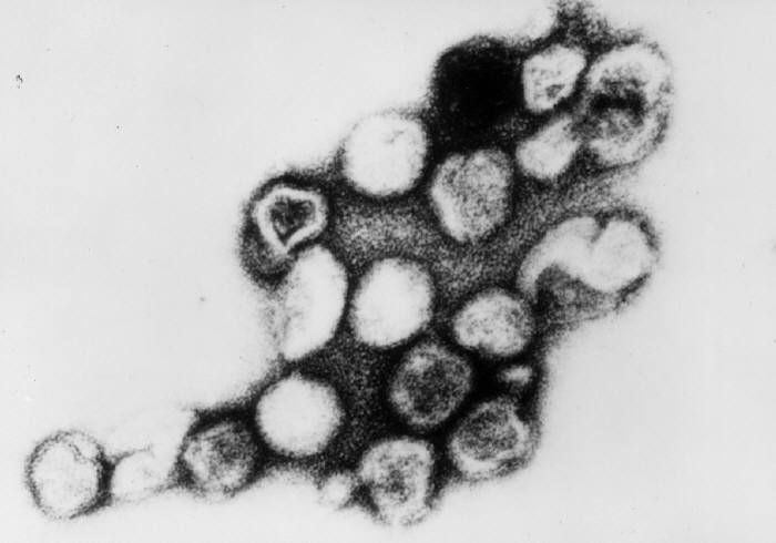 A 1981 transmission electron microscopic image depicting rubella viral particles / Credit: CDC/ Dr. Erskine Palmer