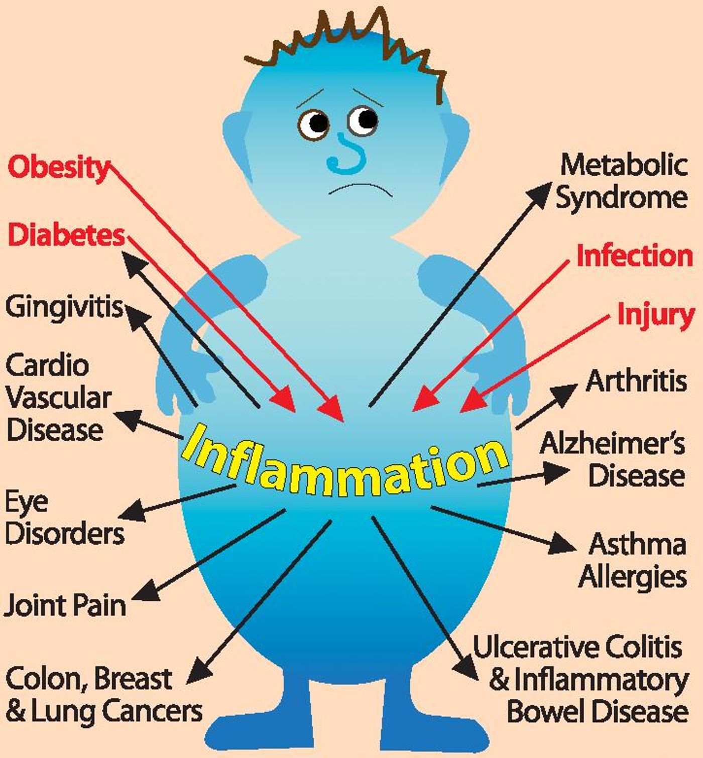 Examples of diseases in which chronic inflammation plays a primary role (Dr. Judi Moore)