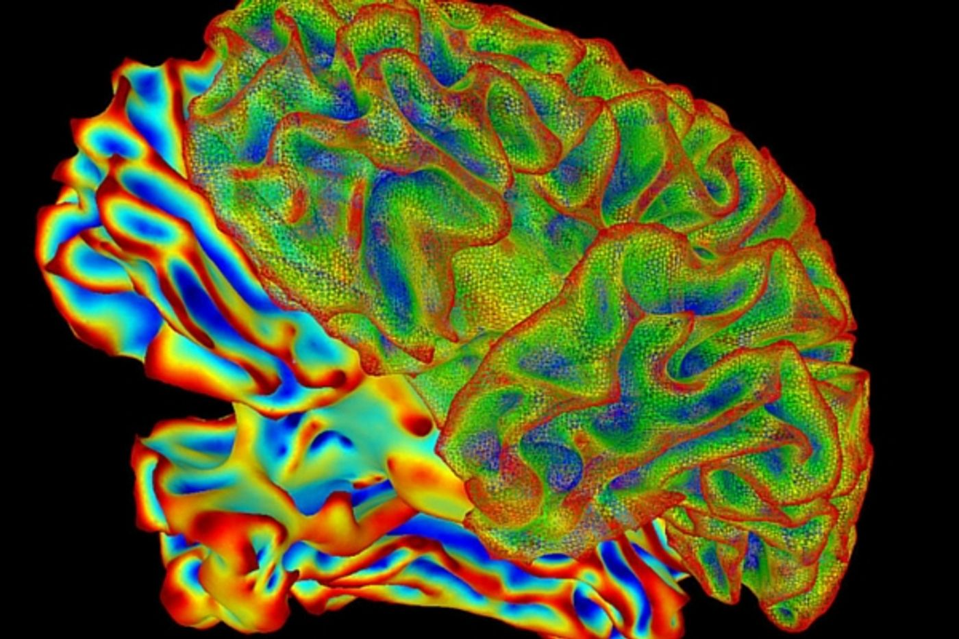 High powered MRIs and holographic technology is what's new in brain imaging