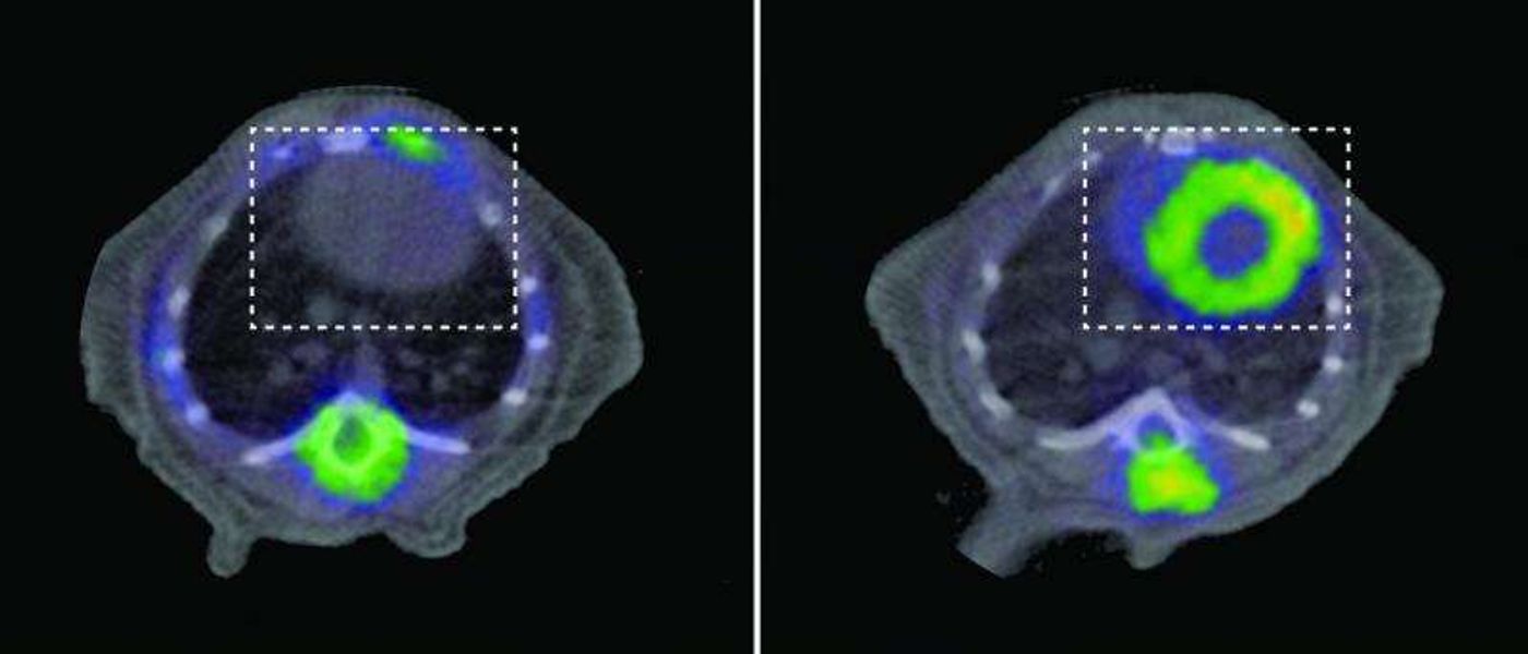 PET scans of a healthy mouse (left) and a mouse with a mitochondrial defect leading to DCM (right)