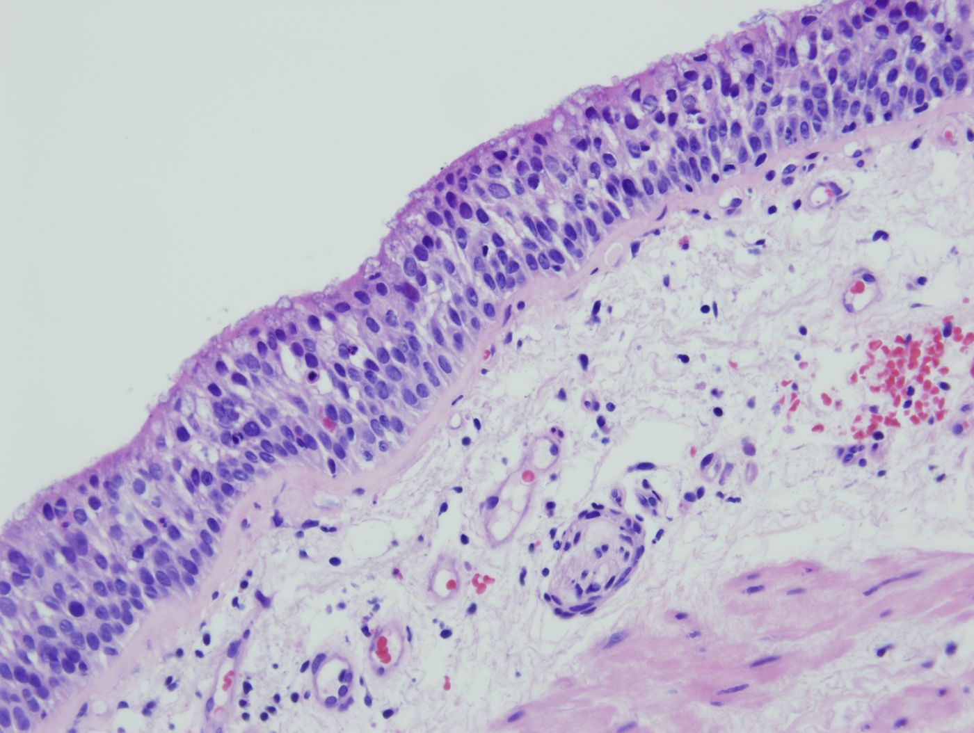 The Same technology that scans galaxies also works to scan for cancer! | Image: Early Research Detection Network