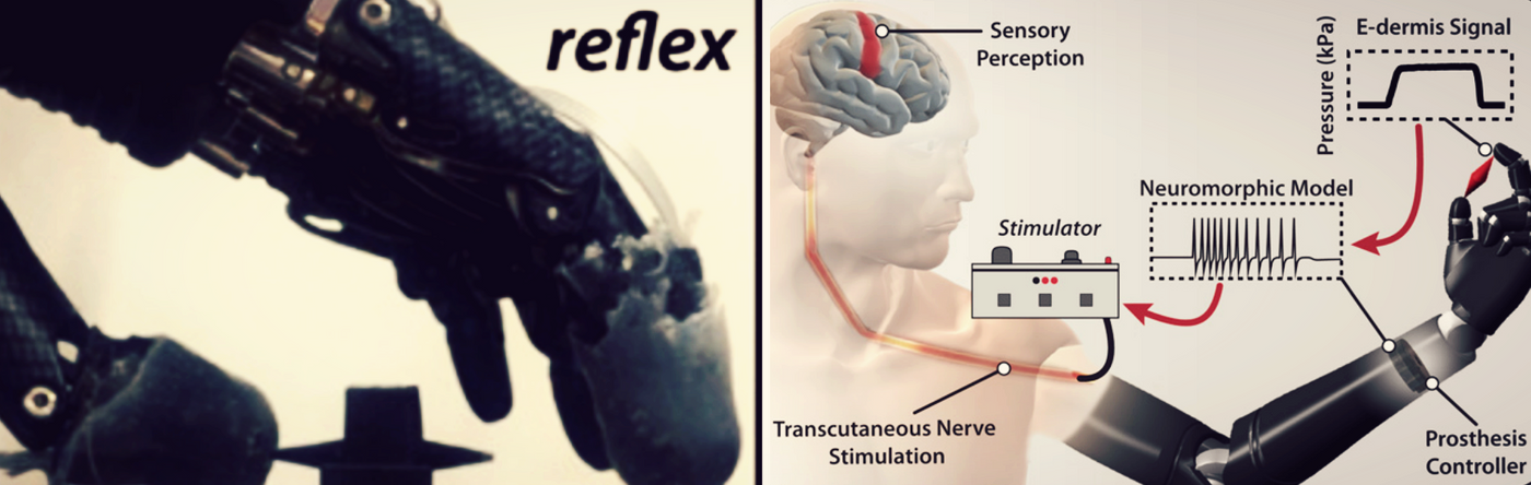 Photo and diagram of prosthesis, credit: Science Robotics