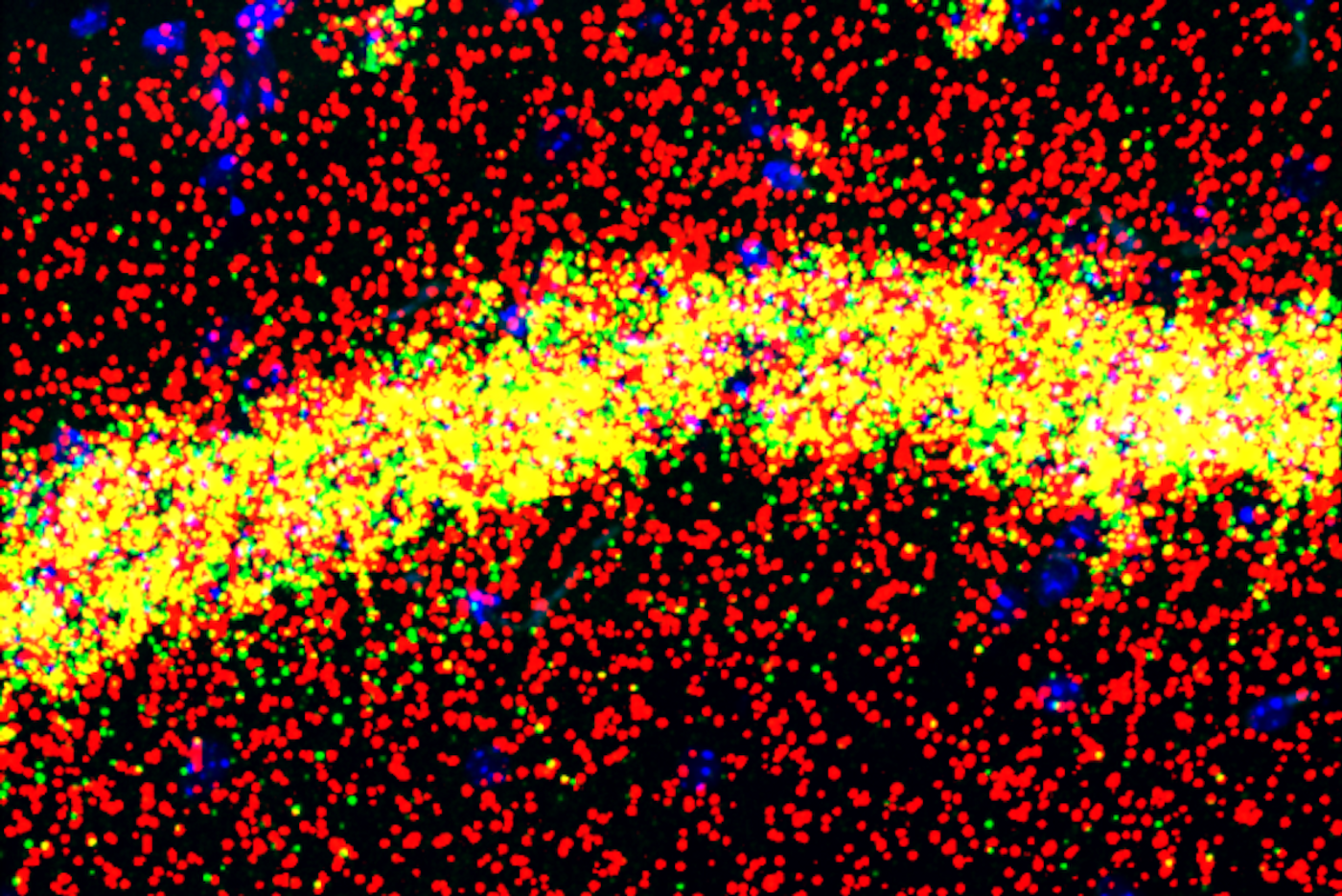 The FMRP protein performs different functions in the cell bodies (yellow) and dendrites (red) of hippocampal memory neurons. / Credit:  Laboratory of Molecular Neuro-oncology at The Rockefeller University