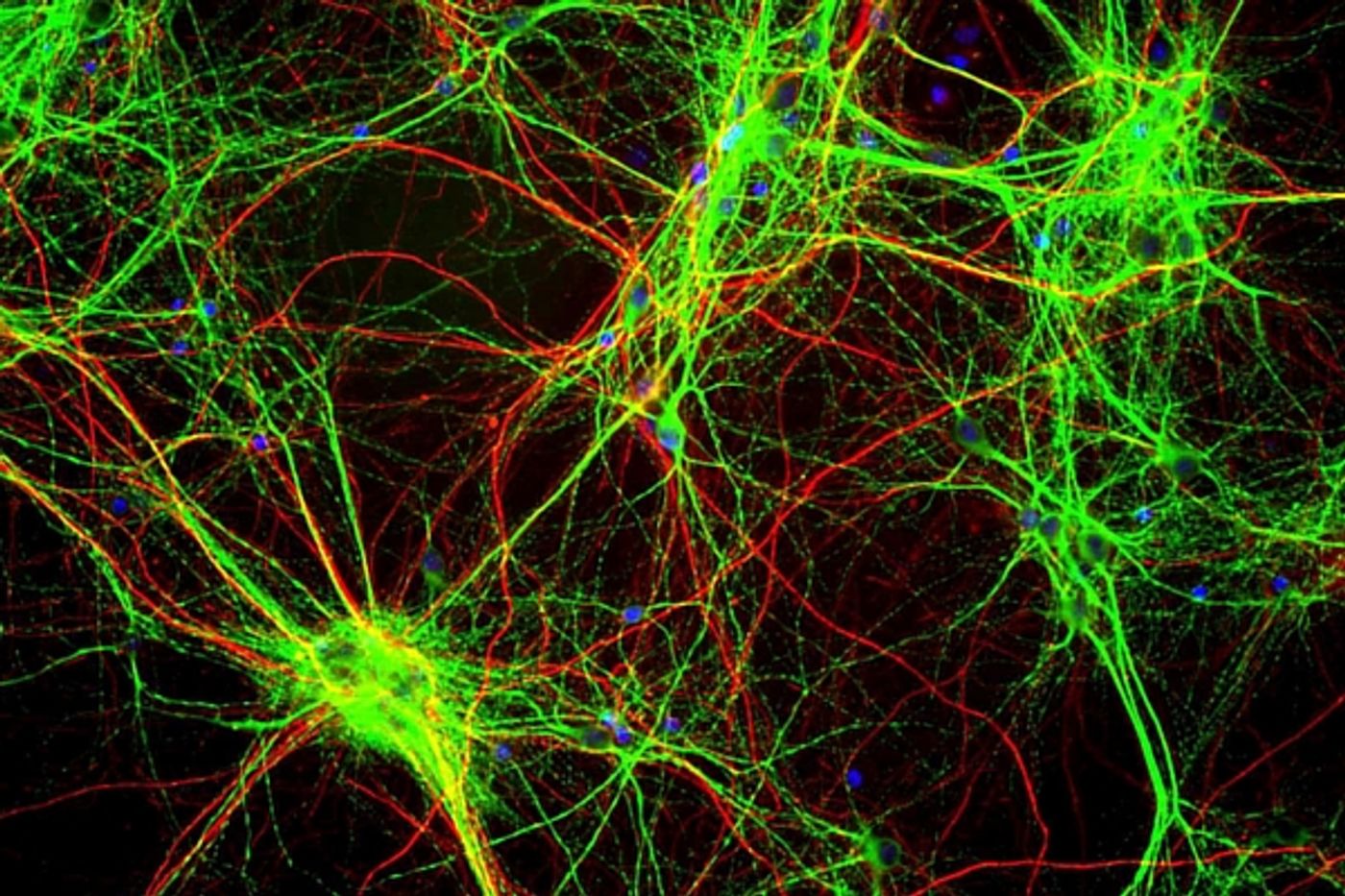 Dendrites are part of how the brain processes visual input