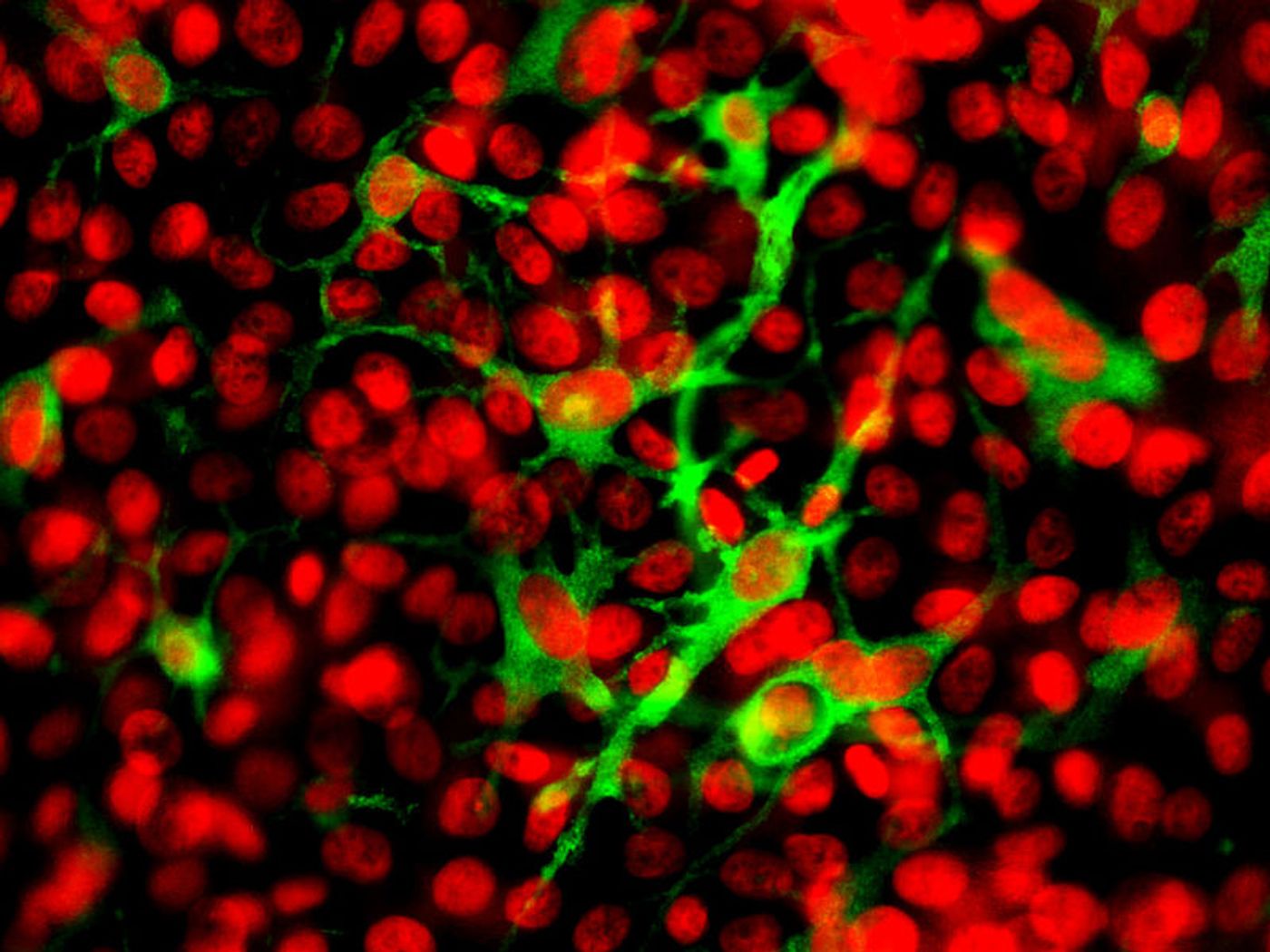 Dendritic cells in the corneal epithelium. Credit: Wikimedia user Zhiguo.he