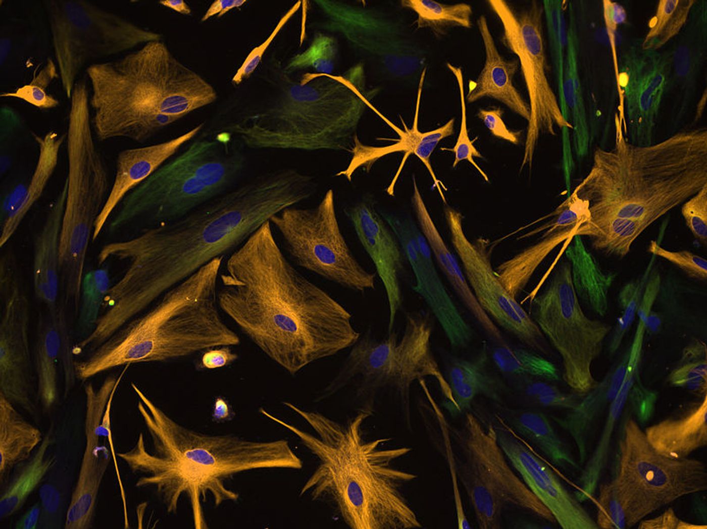 Multipotential Human Neural Progenitor Cells / Credit: NIH