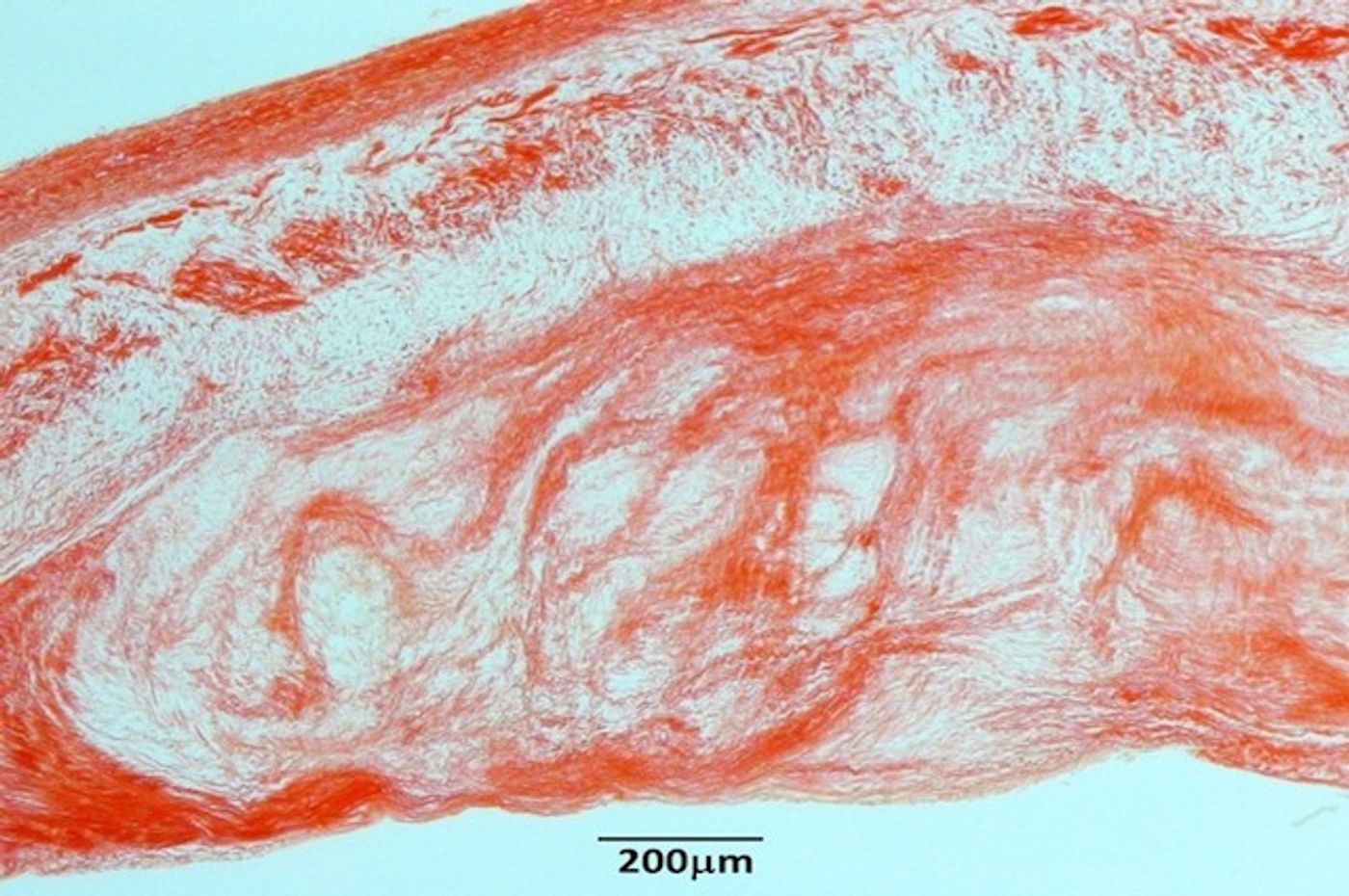 Cross-section of a severely diseased heart valve in a dog with myxomatous mitral valve disease and congestive heart failure. Credit: Tufts University