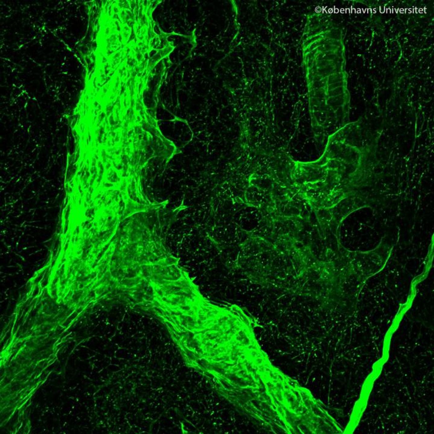 De-cellularized structure of a vessel inside a metastatic lymph node. / Credit: Alejandro Mayorca-Guiliani.