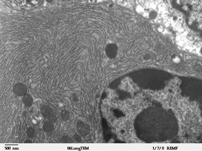 Micrograph of rough endoplasmic reticulum network around the nucleus (shown in lower right-hand side of the picture). Dark small circles in the network are mitochondria. / Credit: Louisa Howard, Dartmouth
