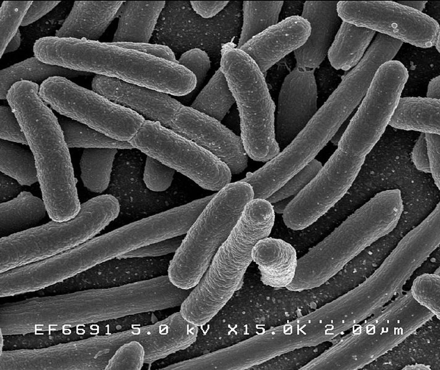 Scanning electron micrograph of Escherichia coli / Credit: Rocky Mountain Laboratories, NIAID, NIH