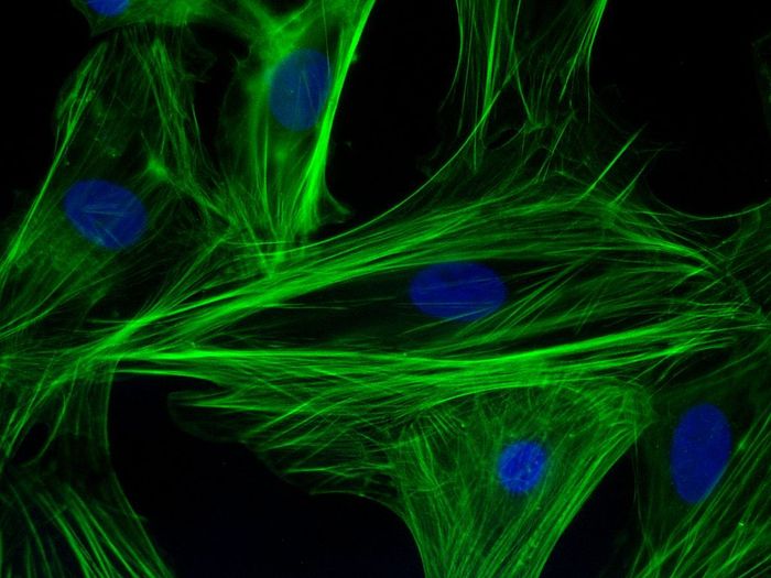 Immunofluorescent staining for F-actin filaments (green) and nuclei (blue) in neonatal cardiomyocytes. Credit: Ps1415