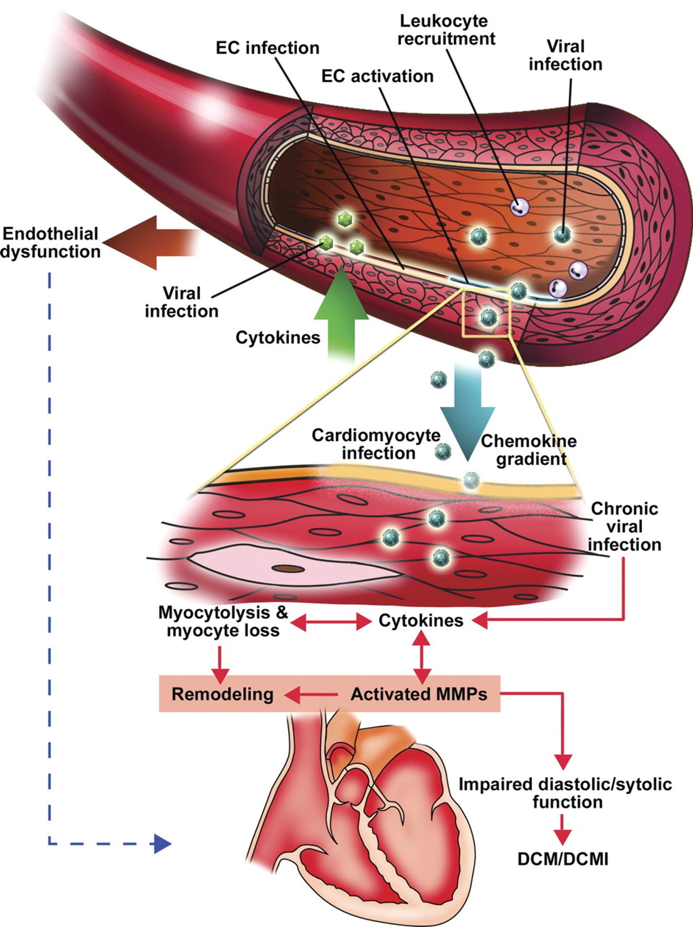 Management of myocarditis 