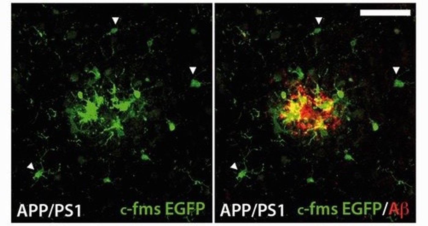 Activated microglia surrounding an amyloid plaque. For full explanation, see figure 3F in Olmos-Alonso, 2016 Brain.