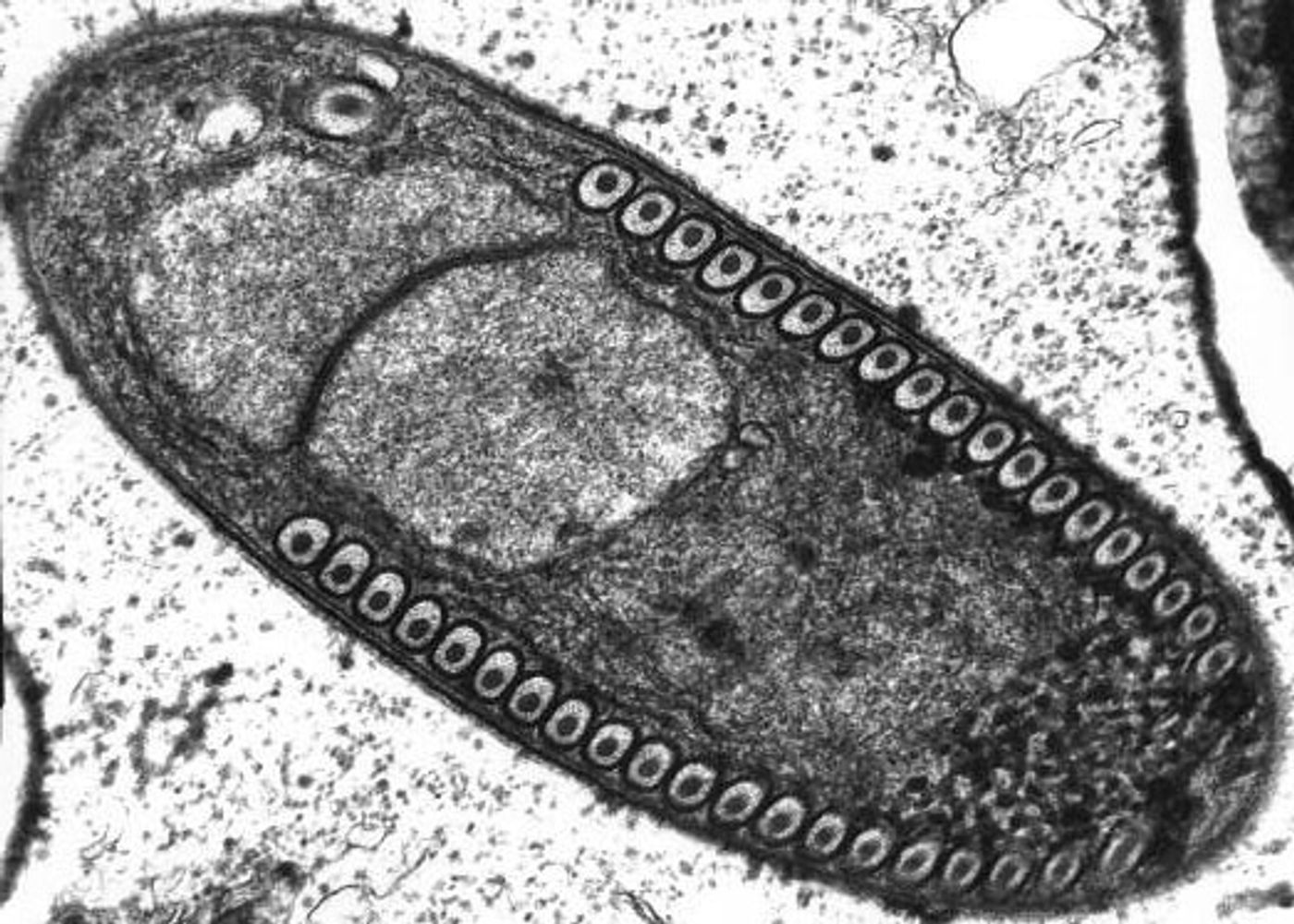Sporoblast of the Microsporidium Fibrillanosema crangonycis. Electron micrograph taken by Leon White.