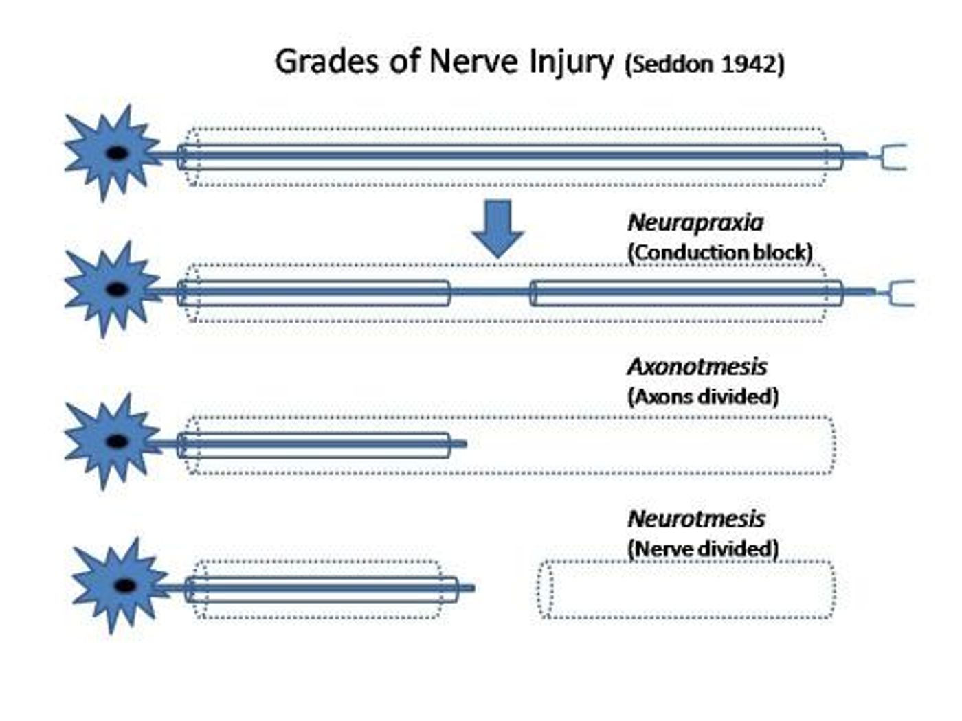 Zapping the nerves to promote nerve regeneration Neuroscience