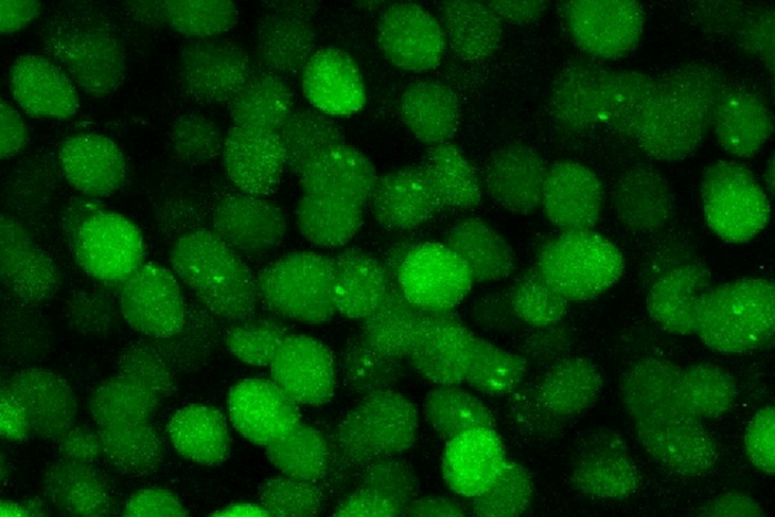 By labeling Arc mRNA (green), researchers could see when and where cells generated it./ Credit: Hye Yoon Park, University of Minnesota Twin Cities