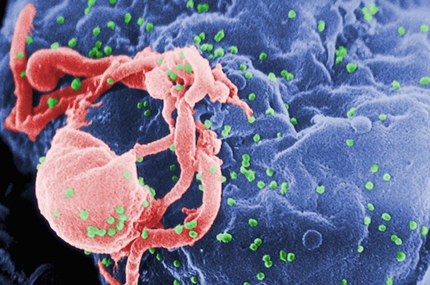 Researchers have come one step closer to eradicating HIV.