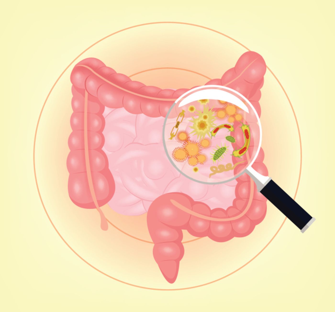 Probiotics may keep your microbiome healthy.