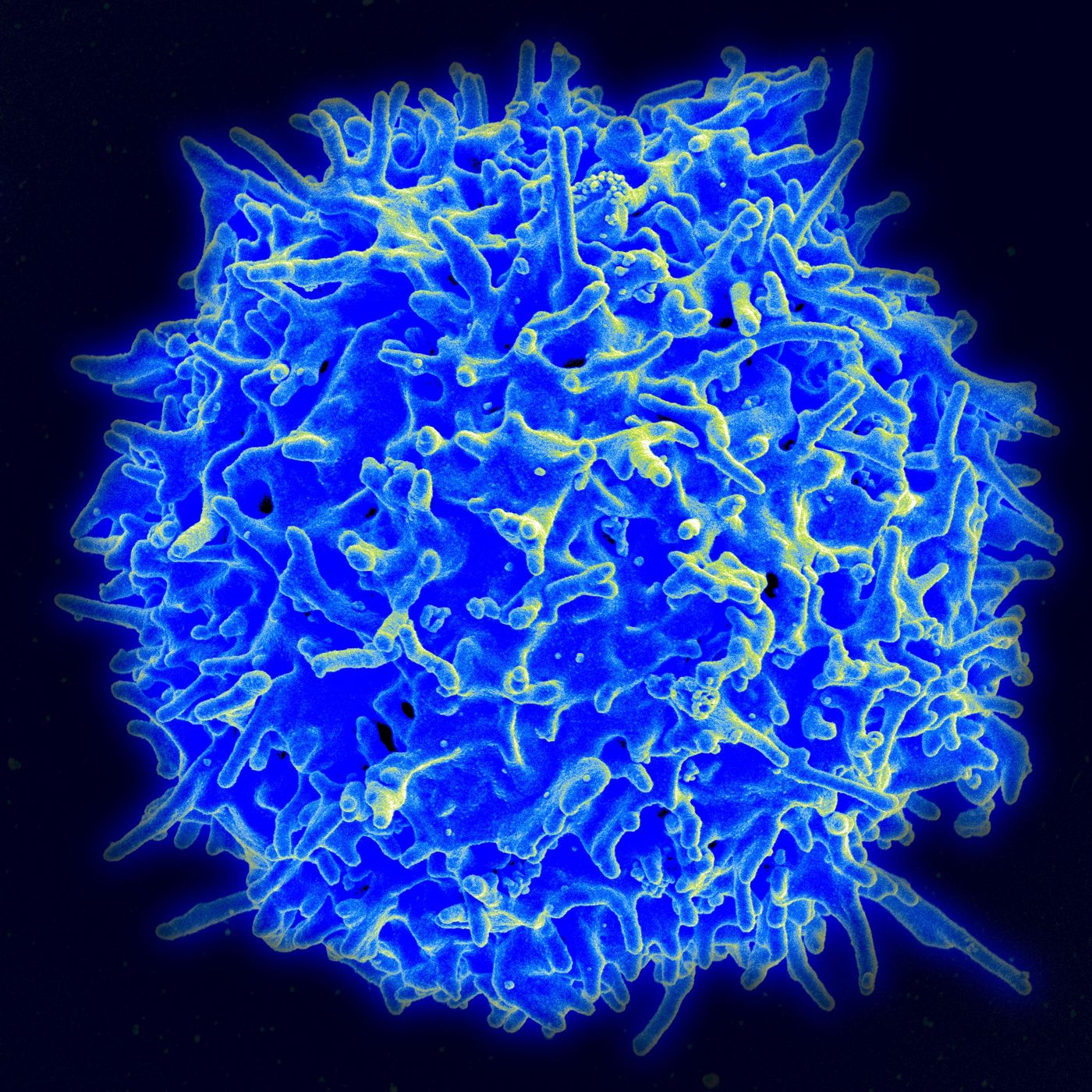 A healthy T lymphocyte
