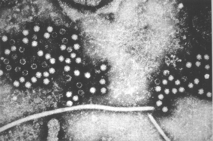 Electron micrograph of Hepatitis E viruses (HEV) / Credit: CDC Public Health Image Library