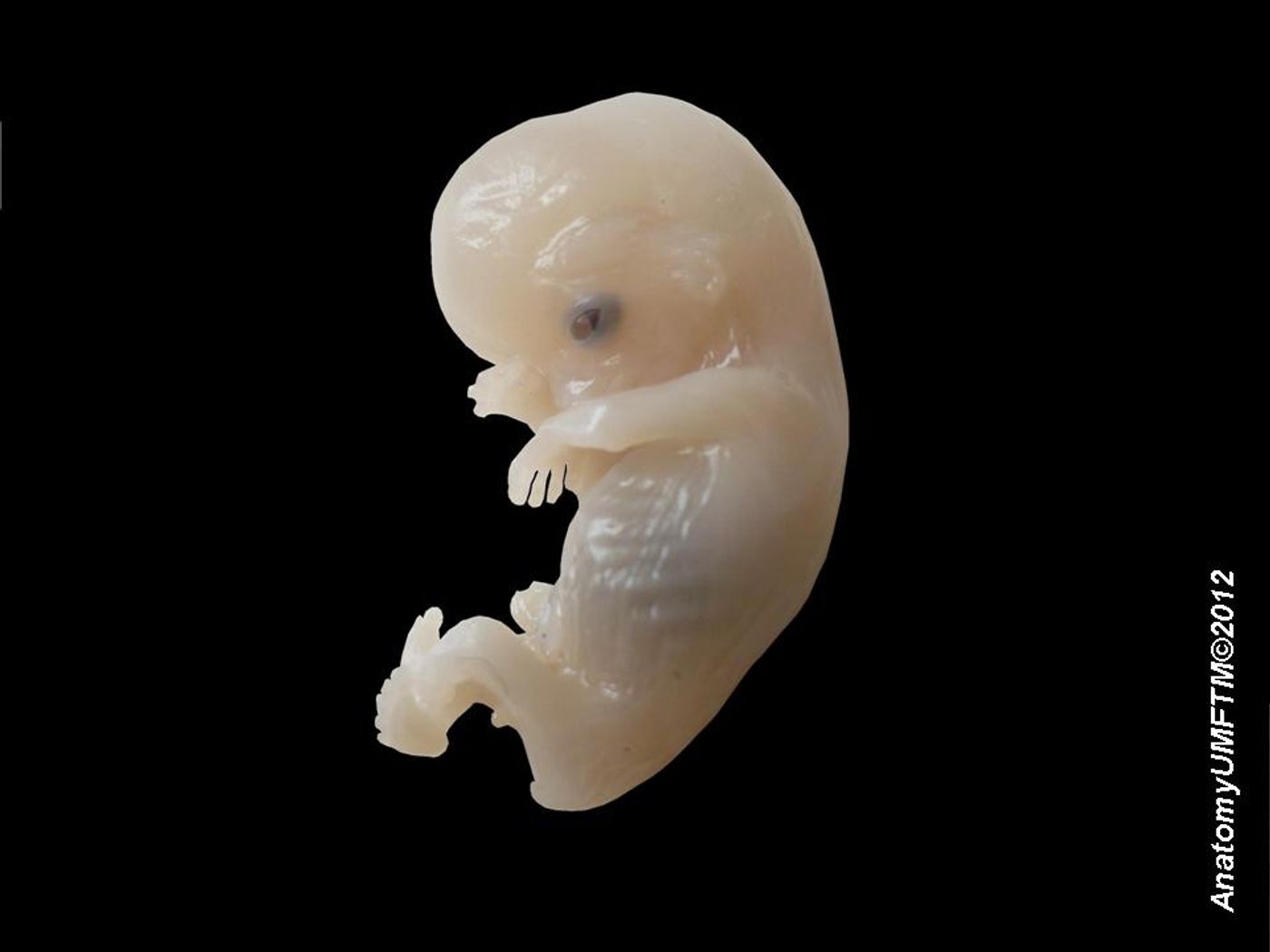 Some mutations now linked to autism risk occur after the zygotic stage of an embryo (human embryo at 8-9 weeks shown) / Credit:Wikimedia Commons/ Anatomist90