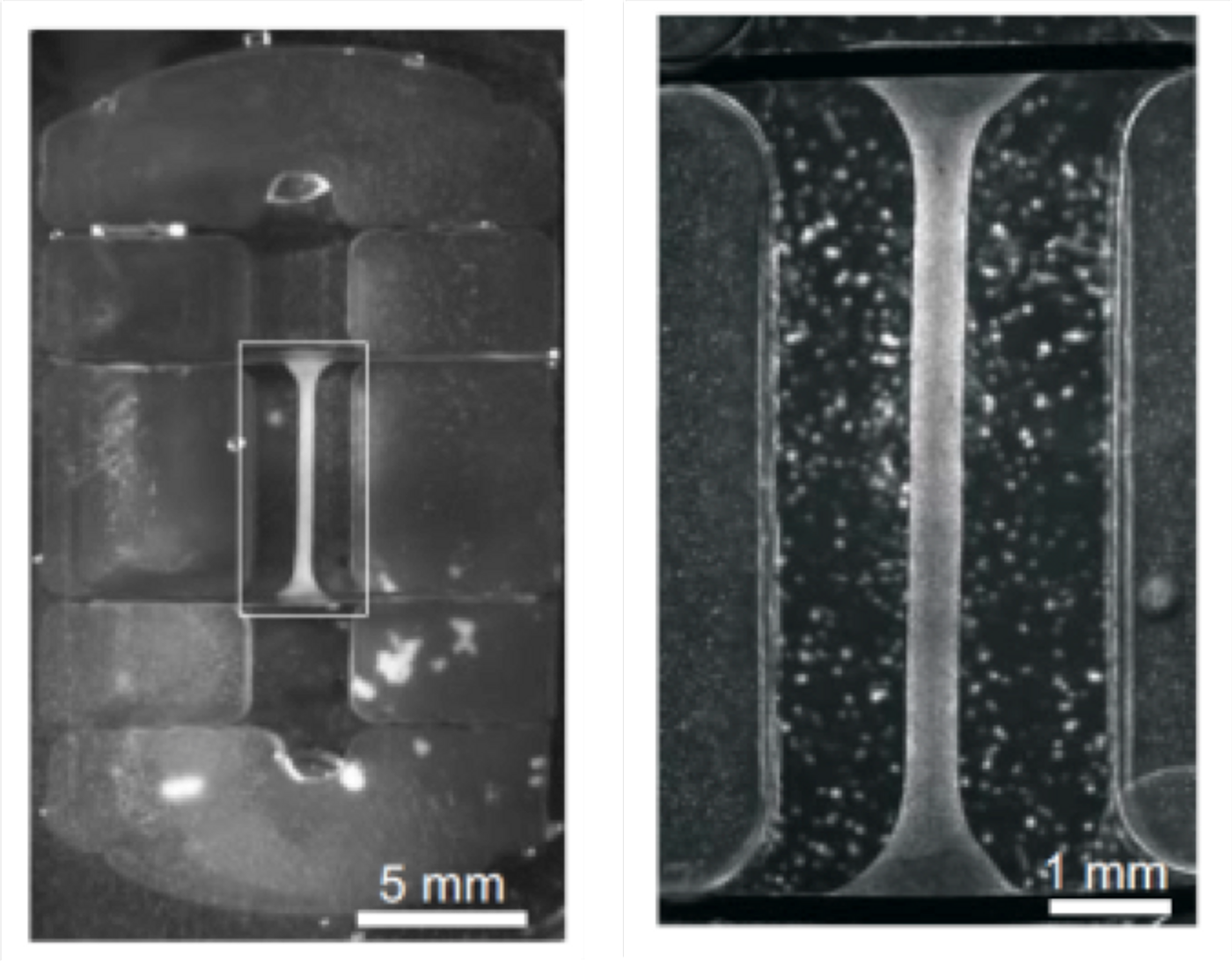 Close up view of the I-Wire cardiac fiber shown at two different levels of magnification. (Credit: VIIBRE/Vanderbilt)