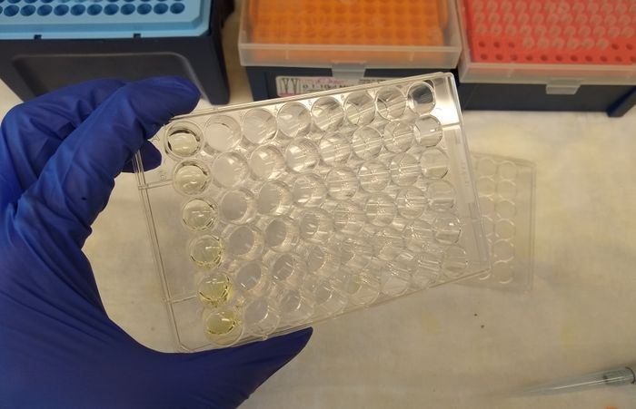 Urine samples are tested in a plate similar to this one / Credit: Carmen Leitch