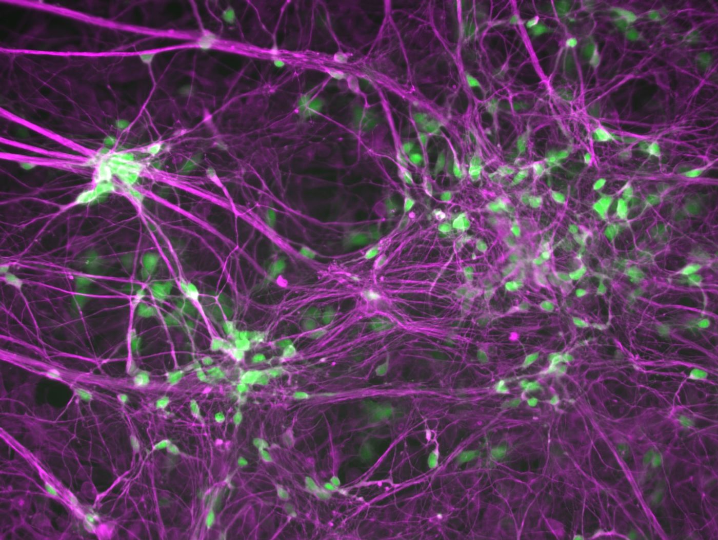 Image Credit Ichida Lab, Keck School of medicine of USC. Human-induced motor neurons that are labeled with a motor neuron marker HB9 in green and a neuron marker TUJ1 in purple.