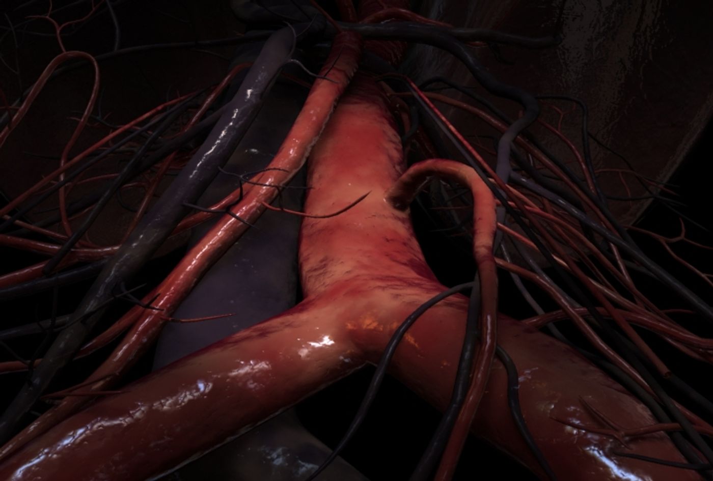 A 3D illustration of the abdominal aorta at the iliac junction. Credit: Scientific Animations