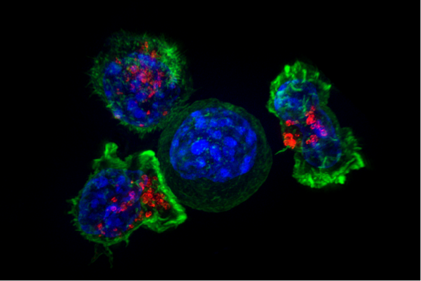 A group of Cytotoxic T cells (green and red) surrounds a cancer cell (blue, center). Credit: NIH