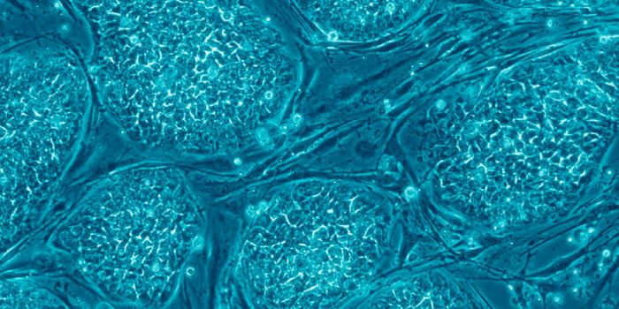 Human embryonic stem cells | Image credit: Wikipedia.org