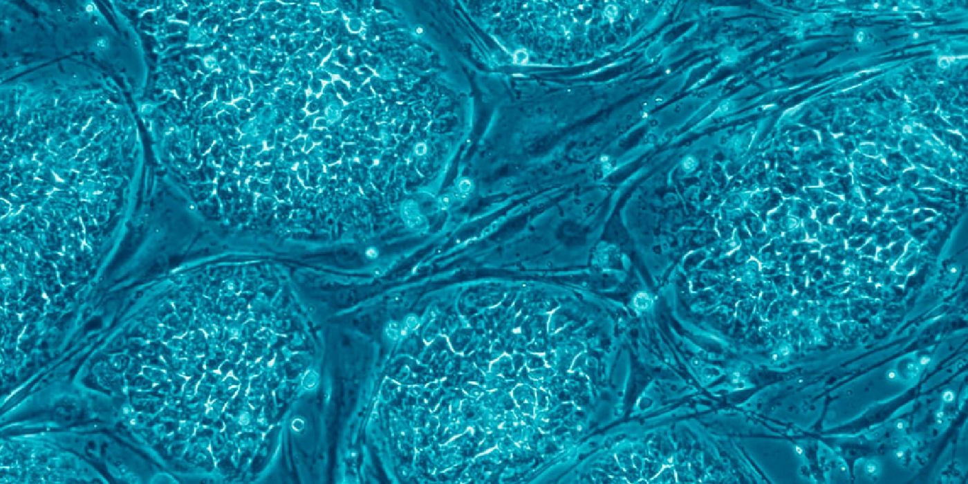 Human embryonic stem cells | Image credit: Wikipedia.org