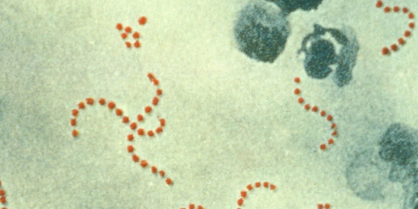 Photomicrograph of Streptococcus pyogenes bacteria, 900x Mag | Image credit: Wikipedia.org
