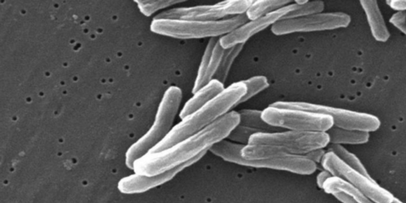 M. Tuberculosis | Image credit: Wikipedia.org