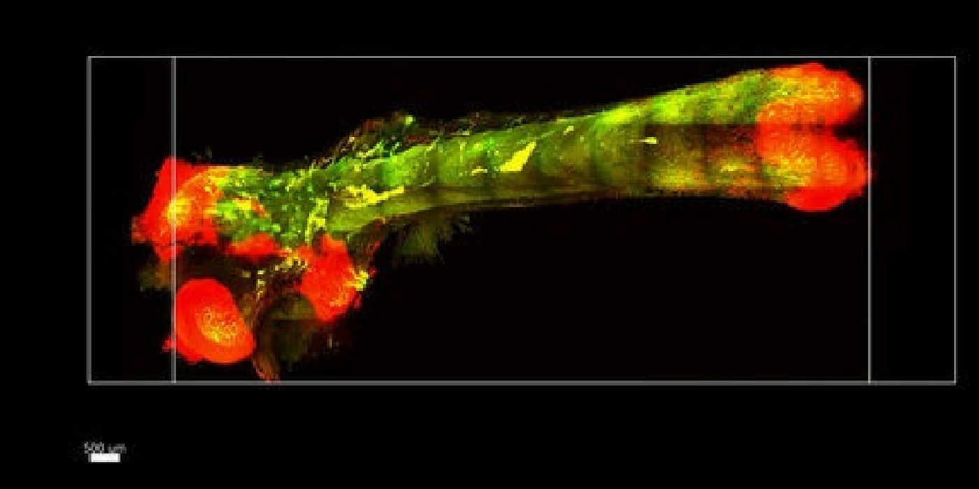 Credit: Science Translational Medicine, Greenbaum, Chan, et al; Gradinaru laboratory/Caltech