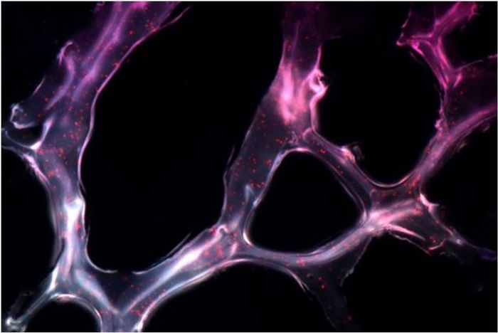 An adhesive hydrogel containing triple twisted microRNAs shrinks cancer in mice.