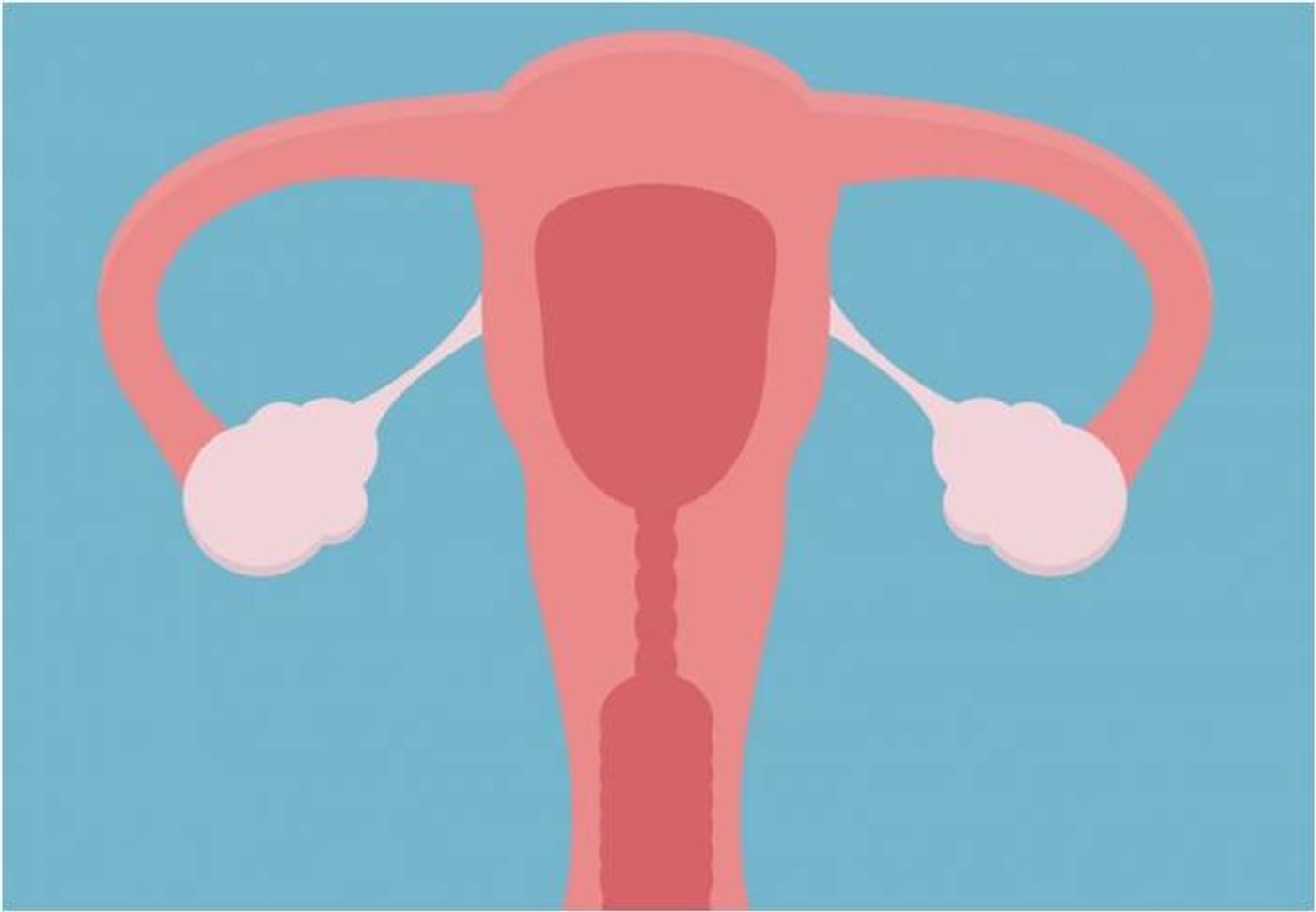 New model predicts ovarian cancer risk with 98% accuracy