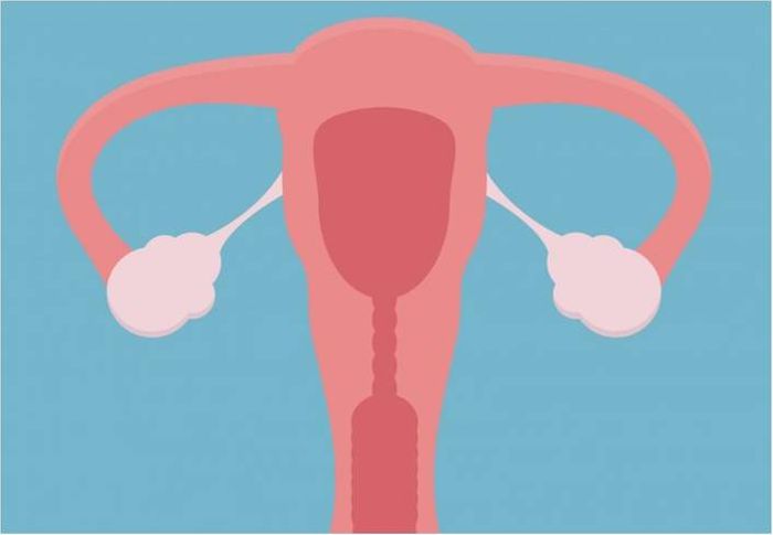 New model predicts ovarian cancer risk with 98% accuracy
