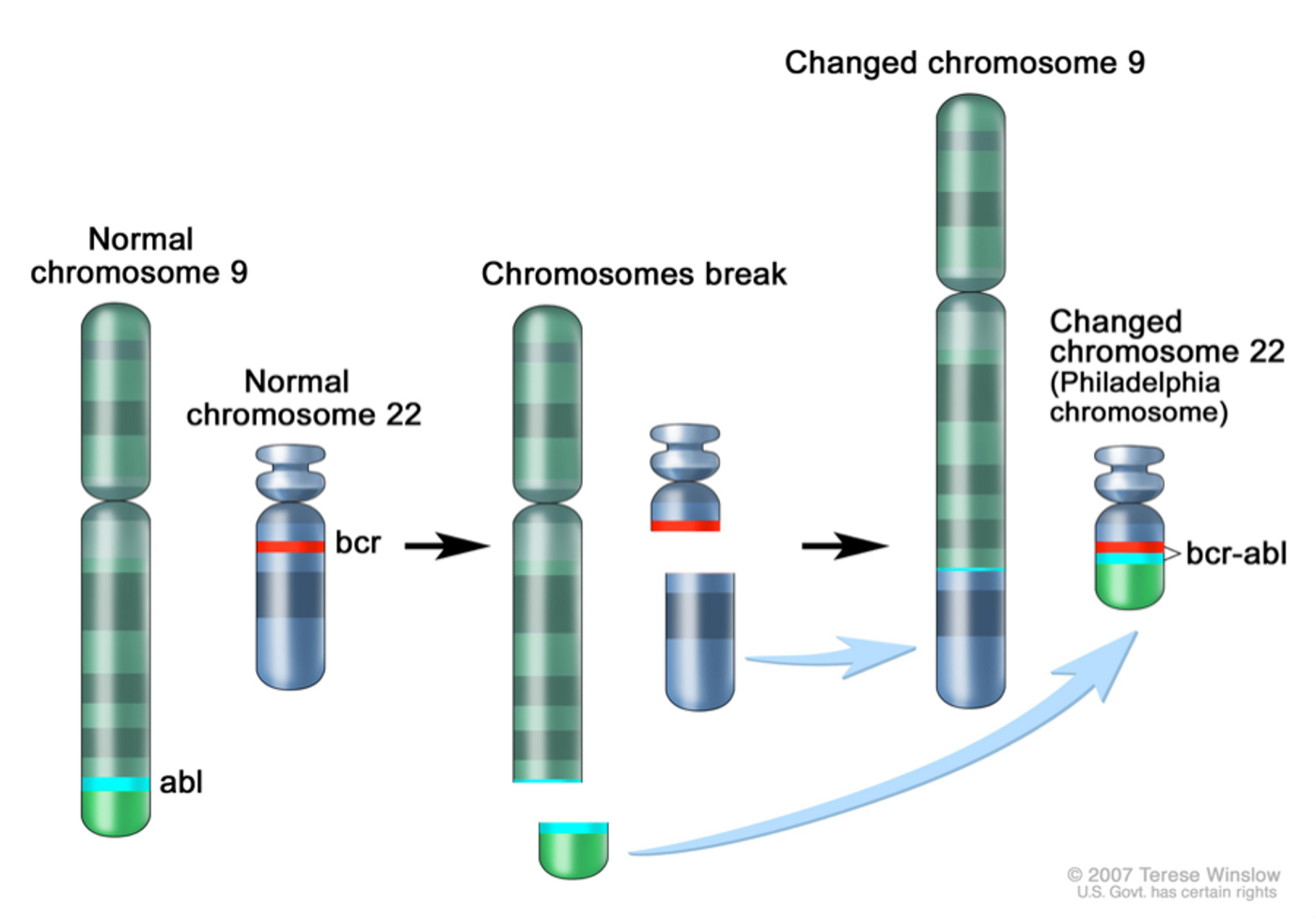 Translocation that results in the BRC-ABL1 fusion protein in CML