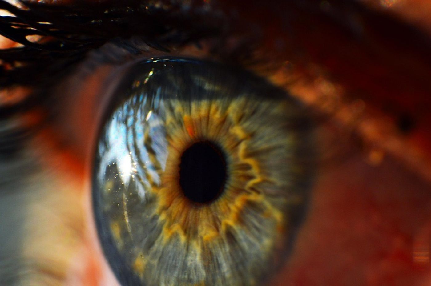 Retina exam may detect Parkinson's before symptoms appear | Image: pixabay.com