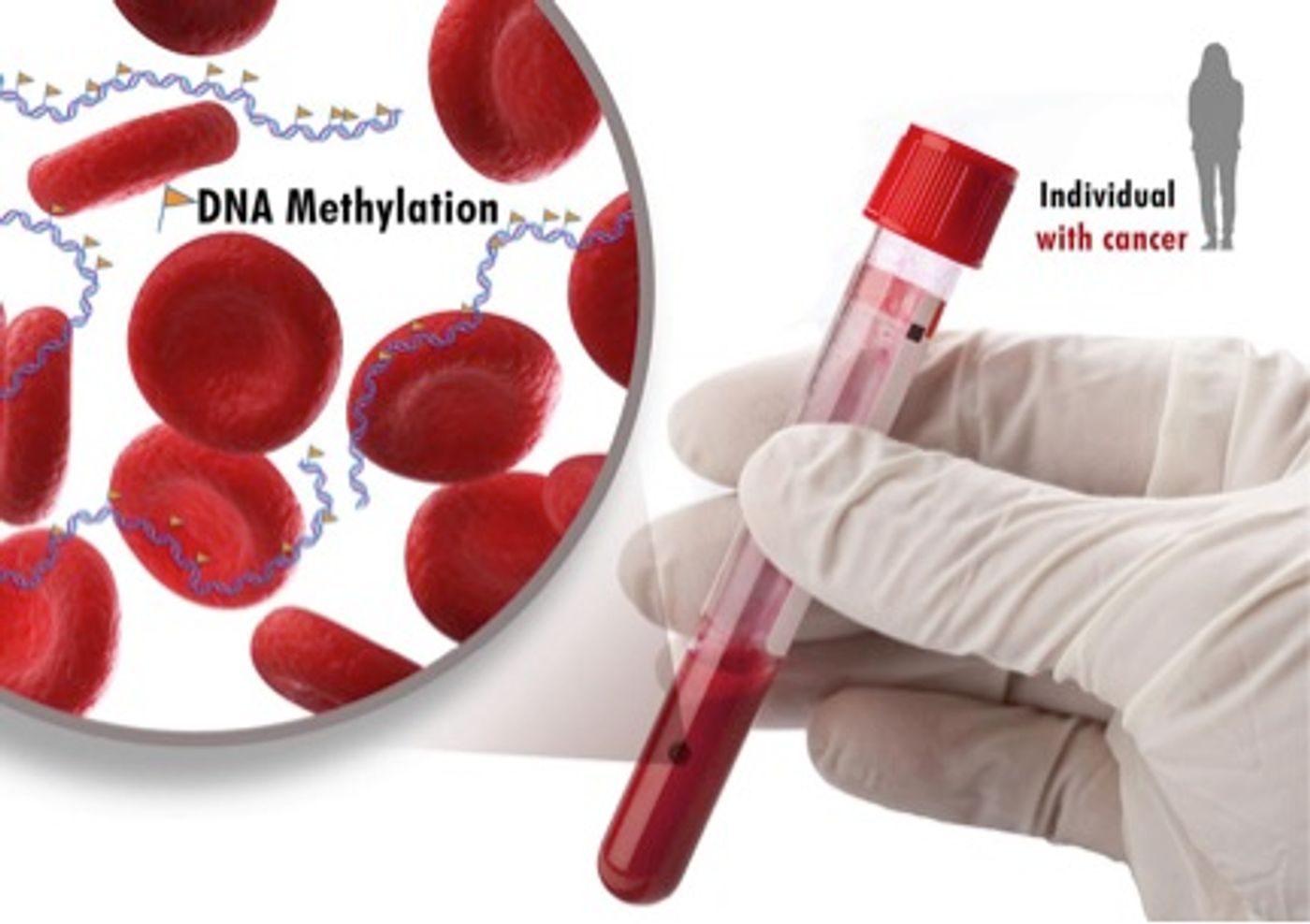 Scientist uncover new cancer methylation mark, diagnostic test possible
