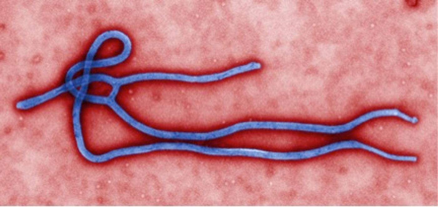 Ebola virus