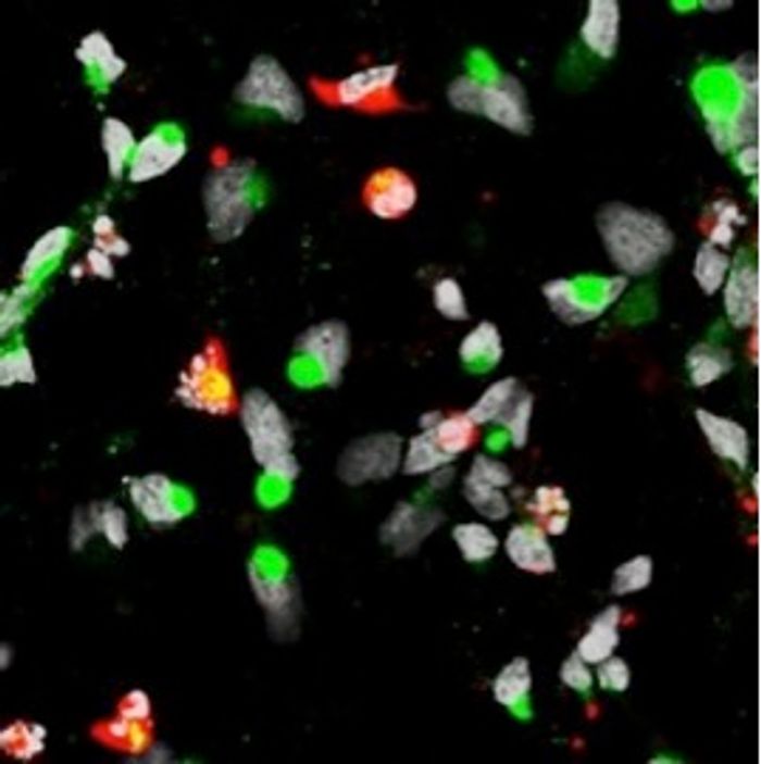 Neural progenitor cells exposed to Zika virus. The virus is shown in green, and cell death is shown in red.