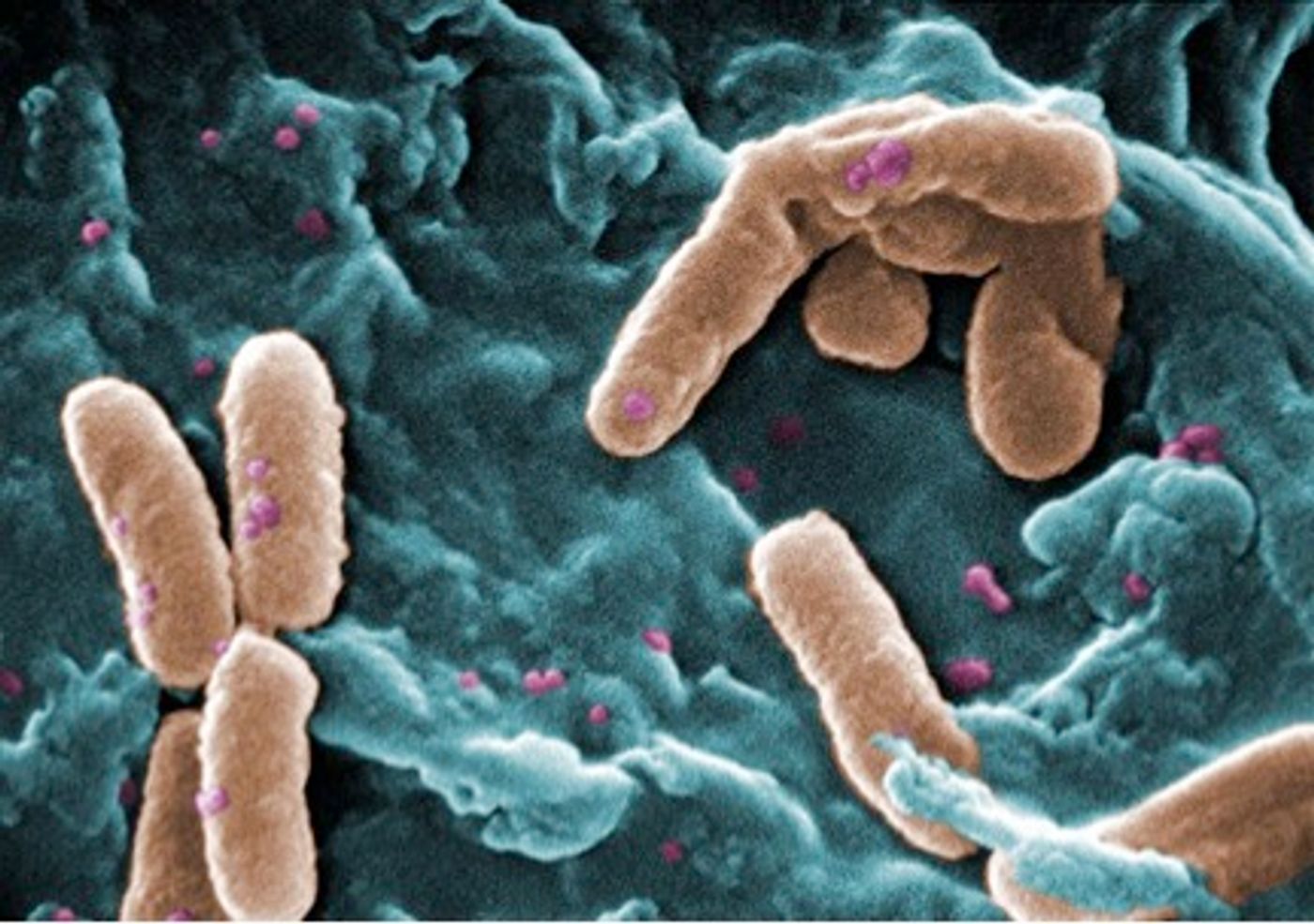Pseudomonas aeruginosa, a bacteria that commonly infects chronic wounds