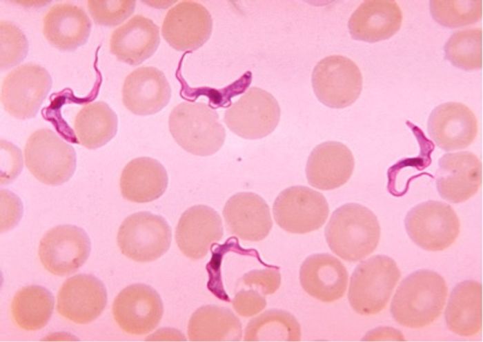 Blood smear showing presence of the HAT-causing parasite.