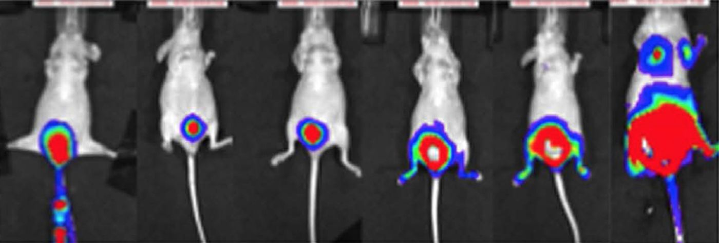 Tumor growth in the xenograft bladder cancer model was monitored using a bioluminescence imaging system. Forty-five days after inoculation, metastatic tumors were detected in the lungs, liver and bone. (Matsumoto R. et. al., Scientific Reports, October 4, 2016)