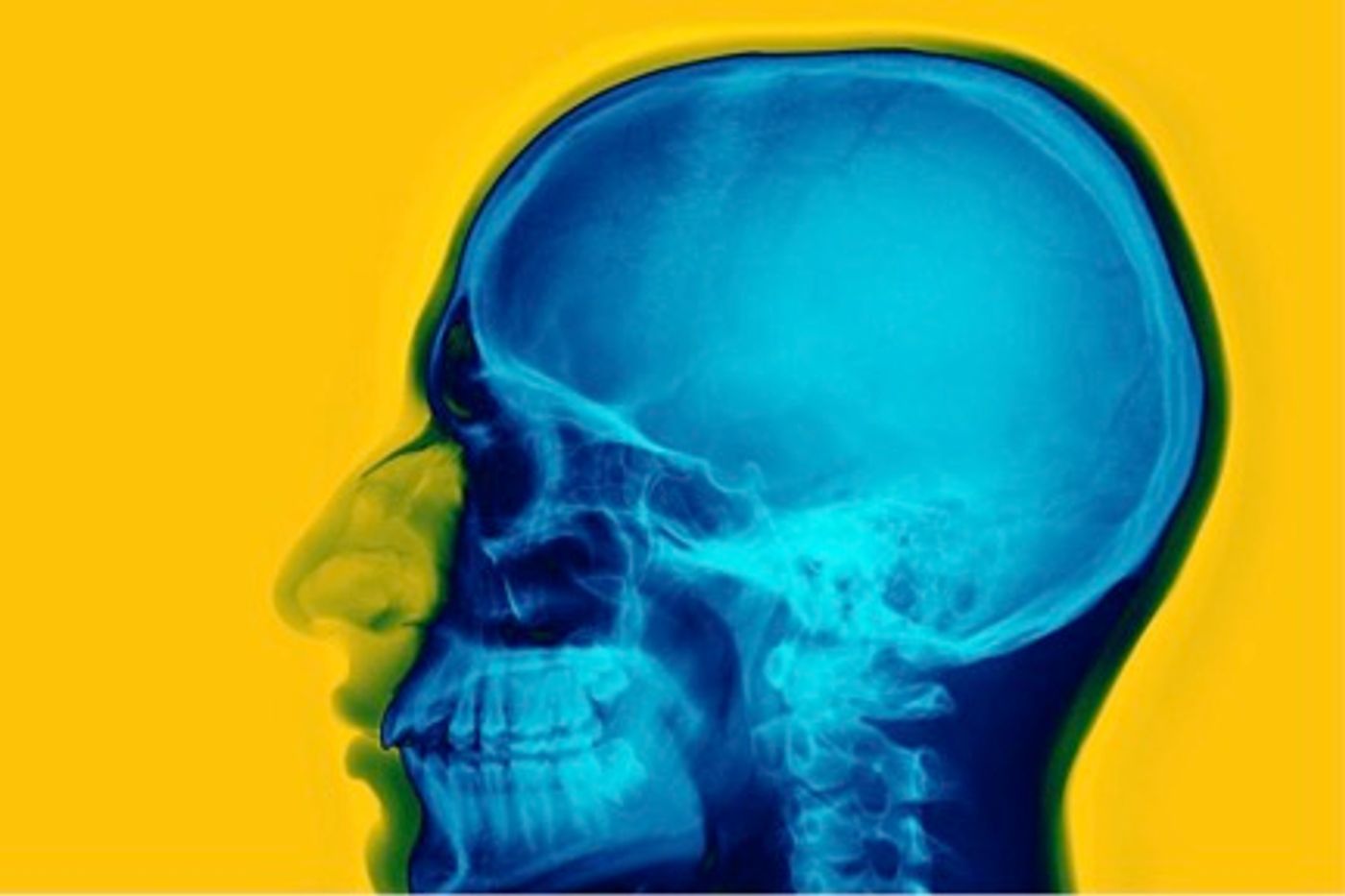 Newly found stem cells can repair damaged skulls