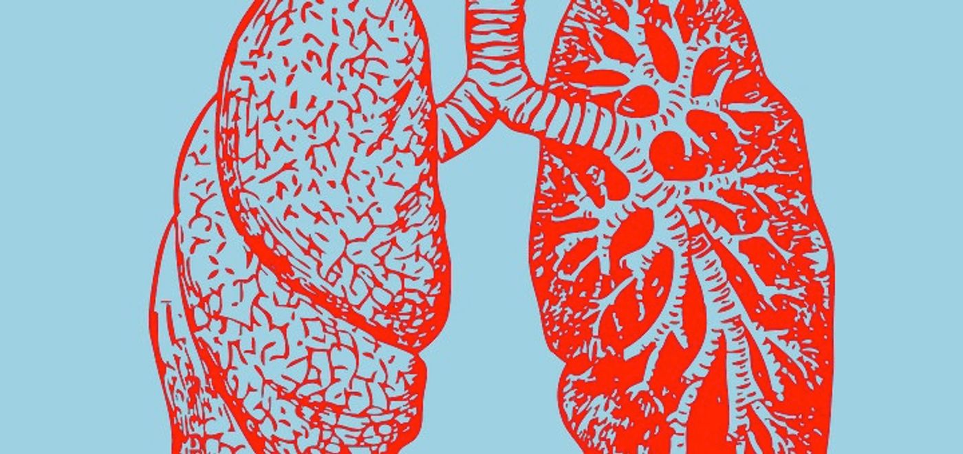 Scientists identify new growth factor involved in lung cancer proliferation