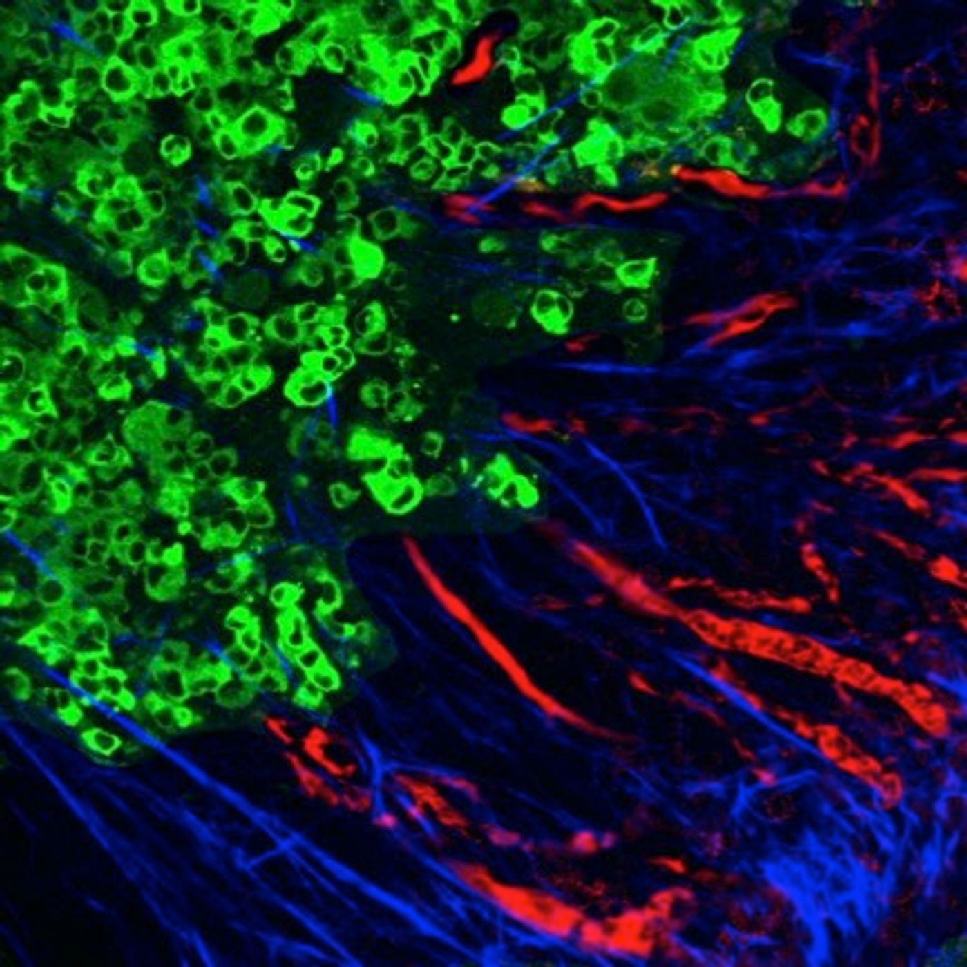 Metastasis in a mouse tumor