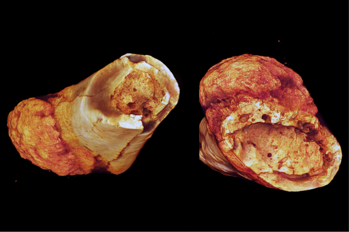 Million year old fossilized cancer in metatarsals | Image: Edward Odes (Wits)